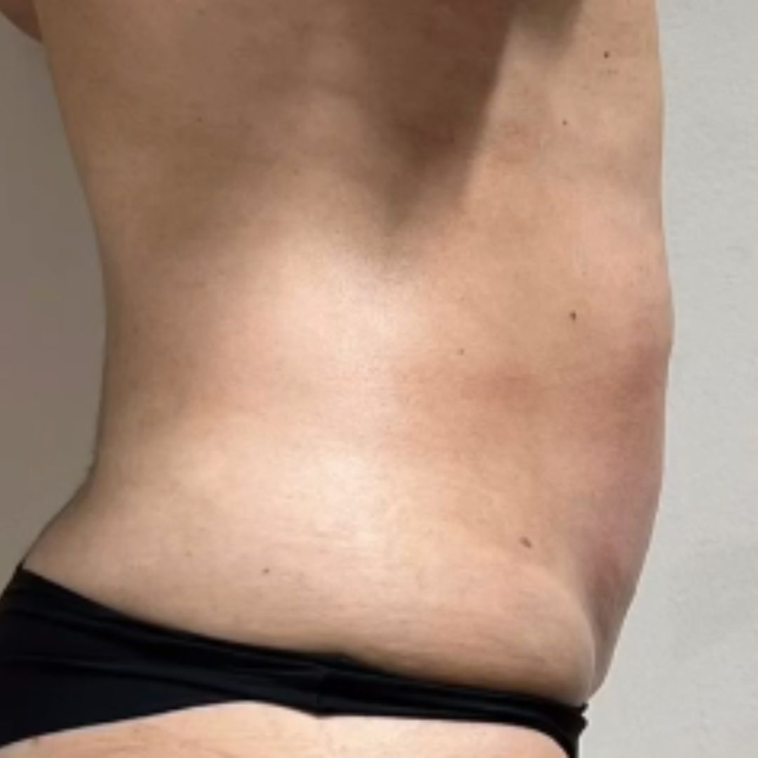After image